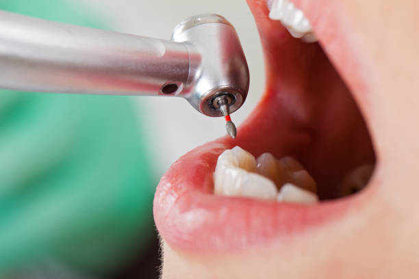 Best Emergency Root Canal Treatment in Big Le, AK